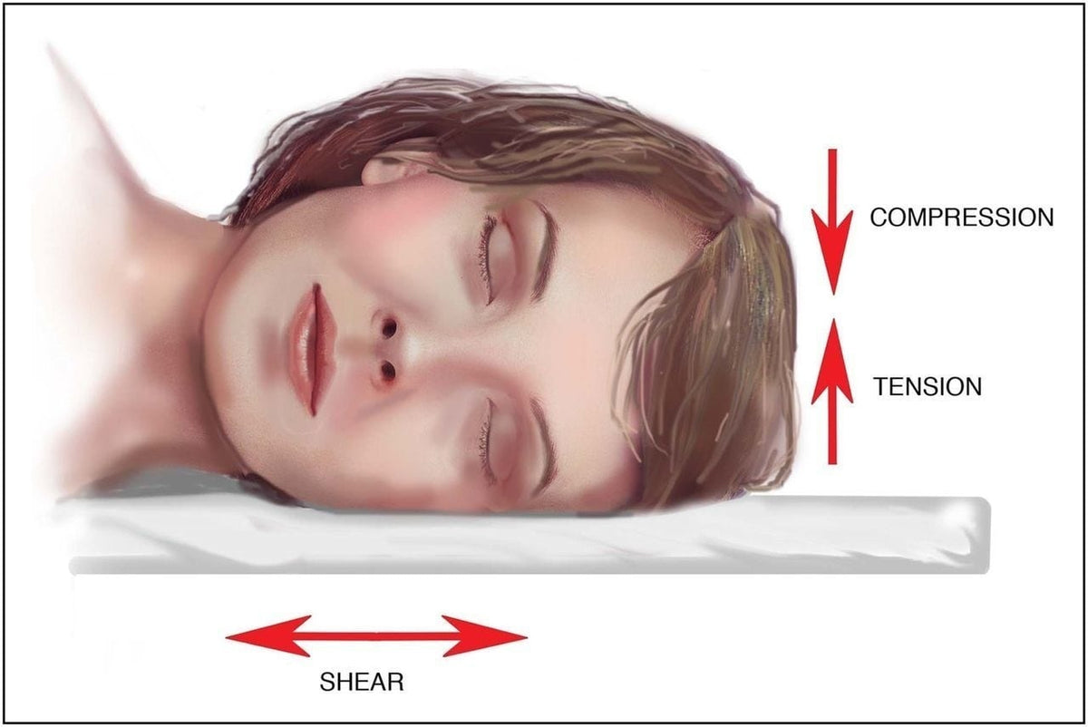 Sleep Wrinkles: Why They Happen and How to Prevent Them